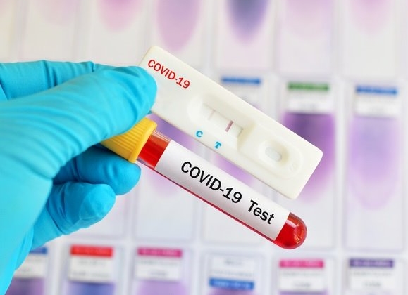 Covid 19
