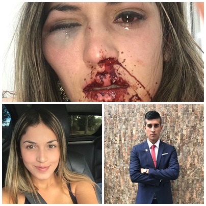 Mujer agredida por su novio