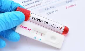 Covid Prueba