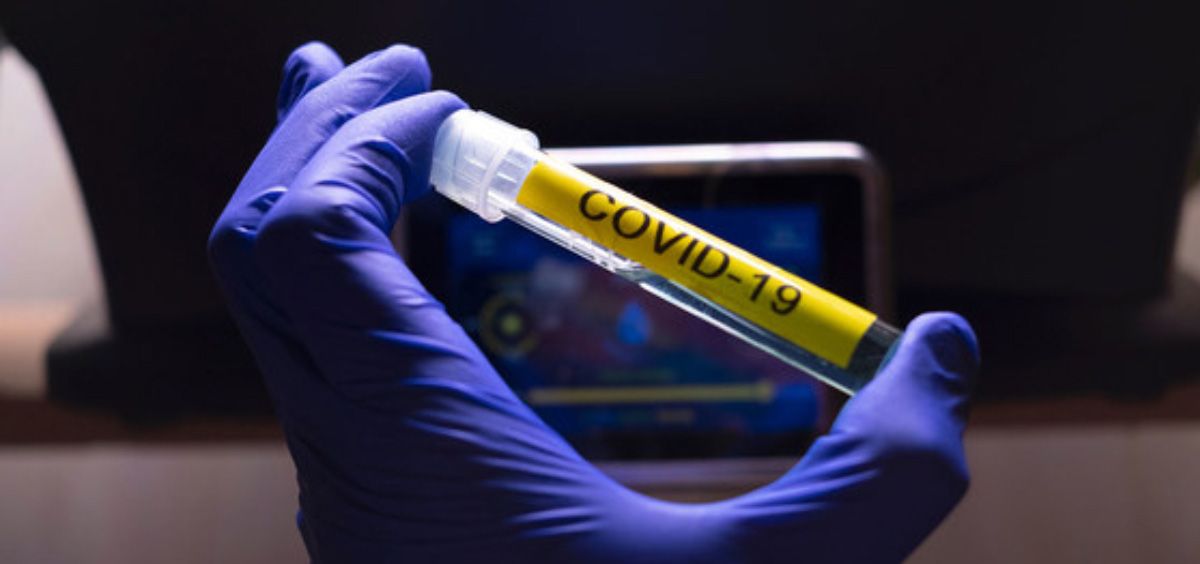 Covid Pruebas