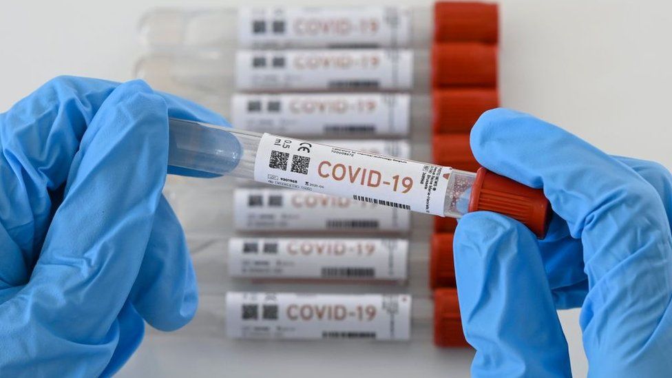 Covid 19 Muestra