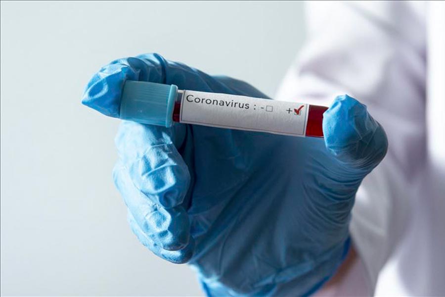 Coronavirus Positivo