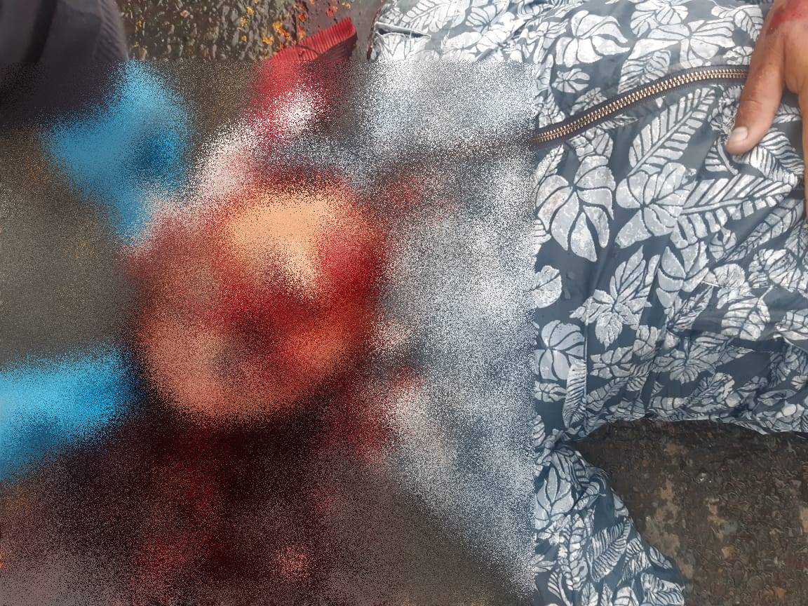 Hombre Asesinado