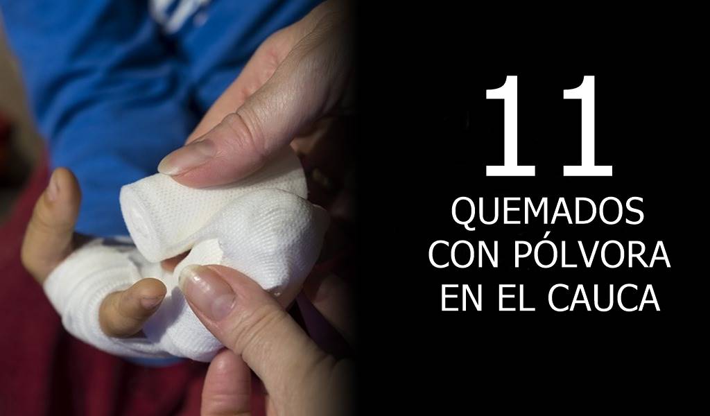 Polvora 11 Quemados